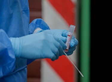 Covid-19: se reportan 3 defunciones y 193 nuevos contagios en Panamá