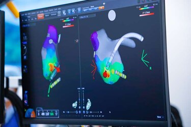 De clínicas privadas a la CSS: tecnología 3D llega al quirófano para tratar taquicardias