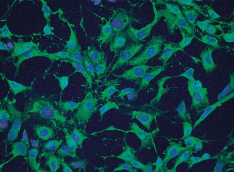 Científicos panameños identifican tratamiento contra el virus mayaro