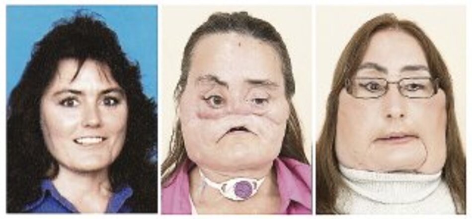 Connie Culp, con nueva cara