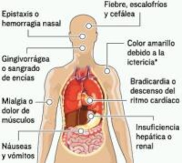 Gorgas y Minsa refuerzan vigilancia de fiebre amarilla en frontera con Colombia