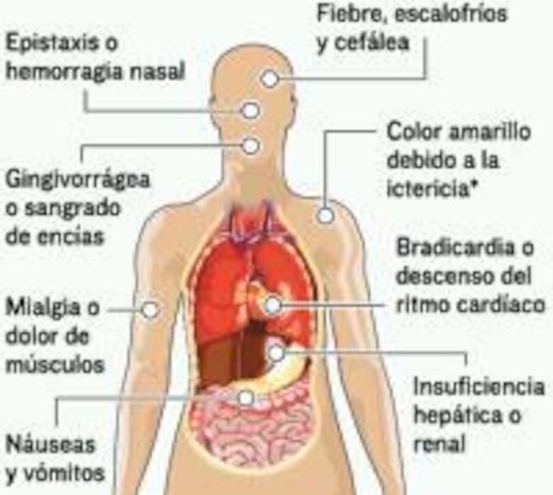Gorgas y Minsa refuerzan vigilancia de fiebre amarilla en frontera con Colombia