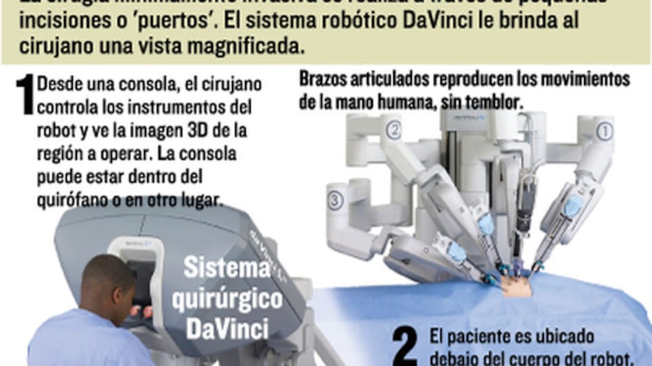 Robots en el quirófano