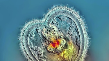 Un panameño gana concurso de fotos de microorganismos