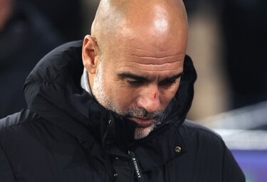 Guardiola explicó la razón del porqué de sus heridas y aseguró no quiso quitarle importancia