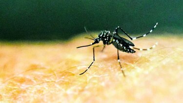 El vínculo entre zika y microcefalia