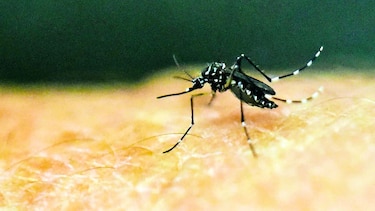 El vínculo entre zika y microcefalia