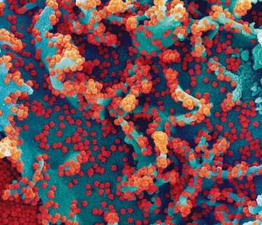 Sistema inmunitario de la llama podría proteger del SARS-CoV-2 y 18 virus más