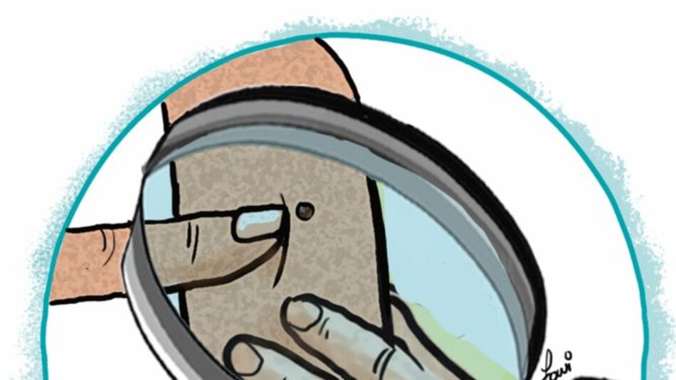 Lunares, ¿señal sexi o de alerta?