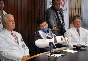 México realiza con éxito el primer trasplante de brazos en América Latina
