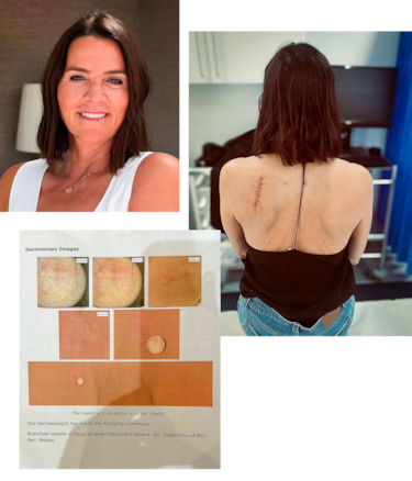 "Me hice un escáner que tomó 2.000 fotos de mi cuerpo y aprendí una inesperada lección sobre mi piel"