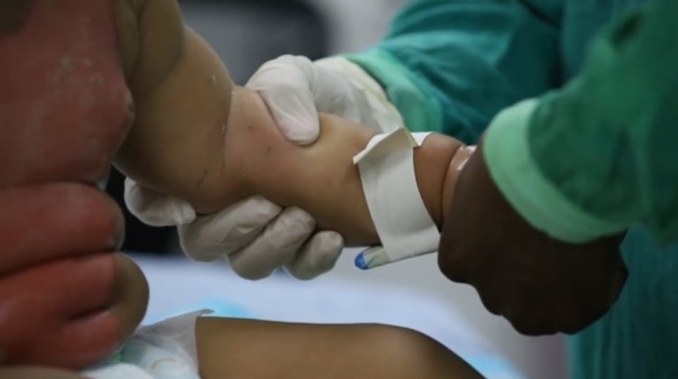 614 niños afectados por quemaduras en solo seis meses: llaman a crear cultura de prevención en Panamá