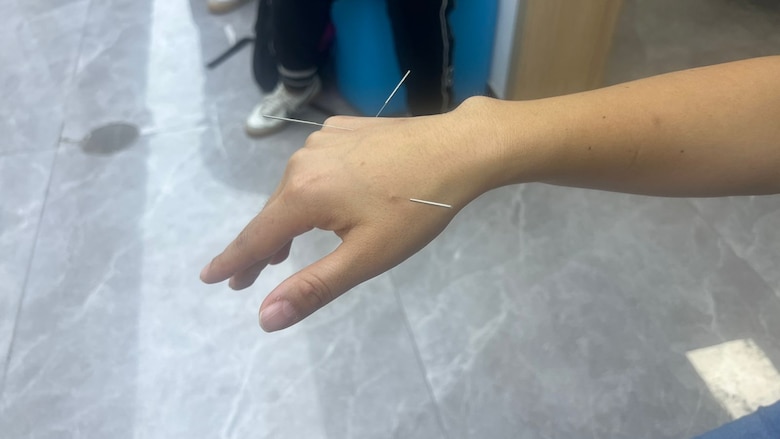 Equilibrio, prevención y cura: el papel de la medicina tradicional china en el siglo XXI