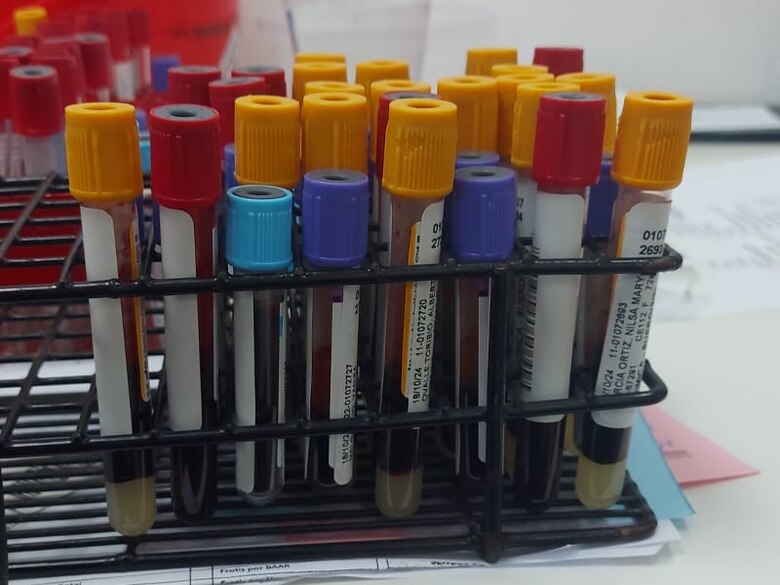 Adquieren nuevos equipos para pruebas de inmunología y serología en el Complejo Hospitalario