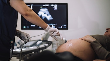 El inusual caso de la colombiana que quedó embarazada de dos hombres al mismo tiempo