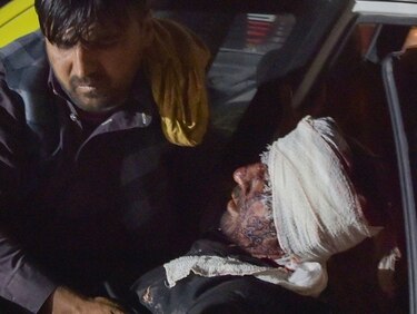 Explosiones afuera aeropuerto de Kabul causan múltiples muertos y heridos