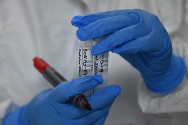 Conalac pide a la población estar alerta ante toma de muestras serológicas por personal no idóneo