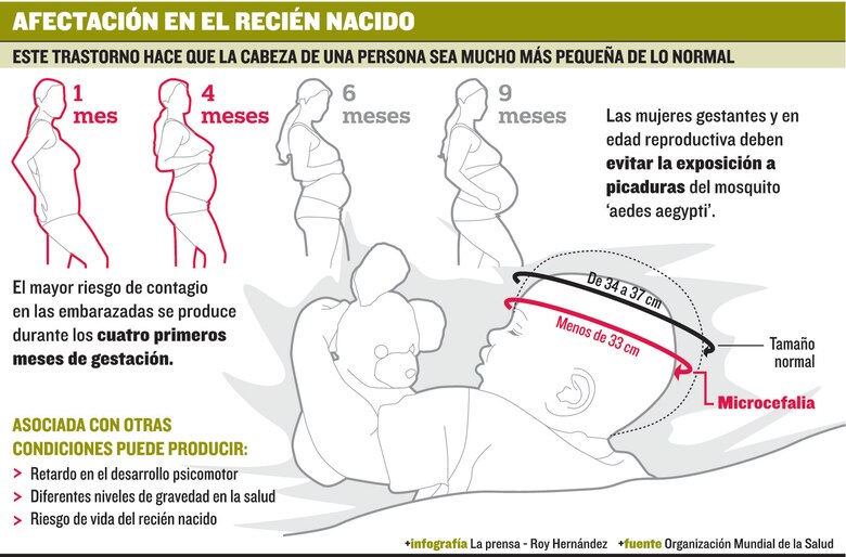 Muerte por microcefalia obliga a extremar medidas