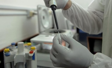 Identifican por primera vez la causa genética de lupus en un individuo