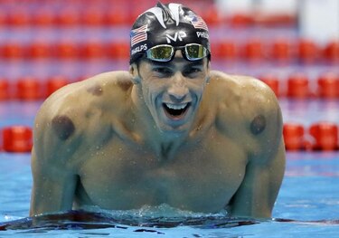 Las marcas circulares de Phelps por 'cupping' disparan el orgullo en China