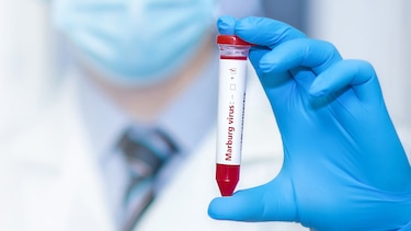 El virus de Marburgo: qué es, cómo se transmite, sus síntomas y origen