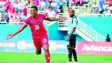 Roberto Nurse será baja por seis meses