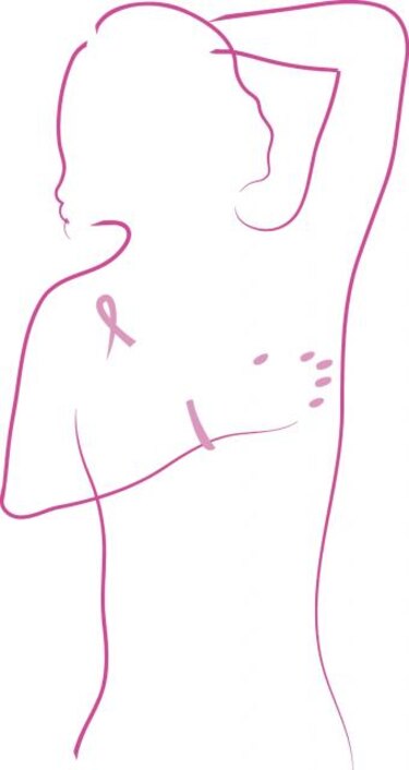 Desarrollan nueva plataforma para el tratamiento del cáncer de mama