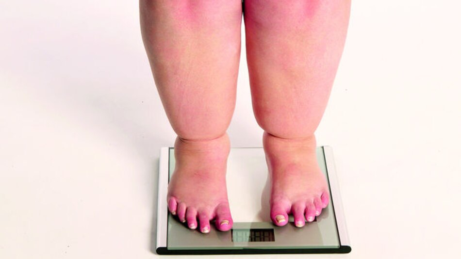 Más obesos en el mundo