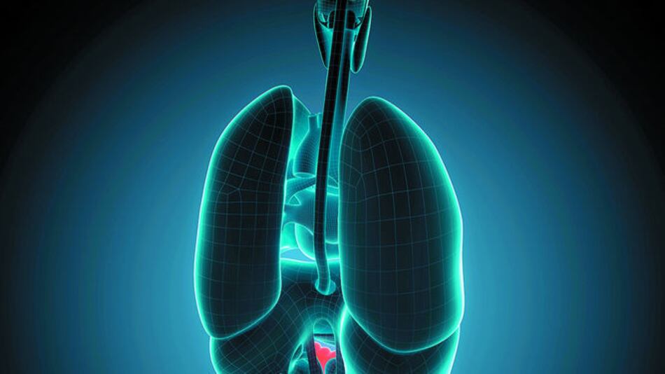 Prevención del cáncer de colon