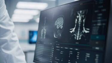 El Minsa recibió 3 ofertas en la licitación exprés del servicio de radiología; Reserma quiere quedarse con el contrato