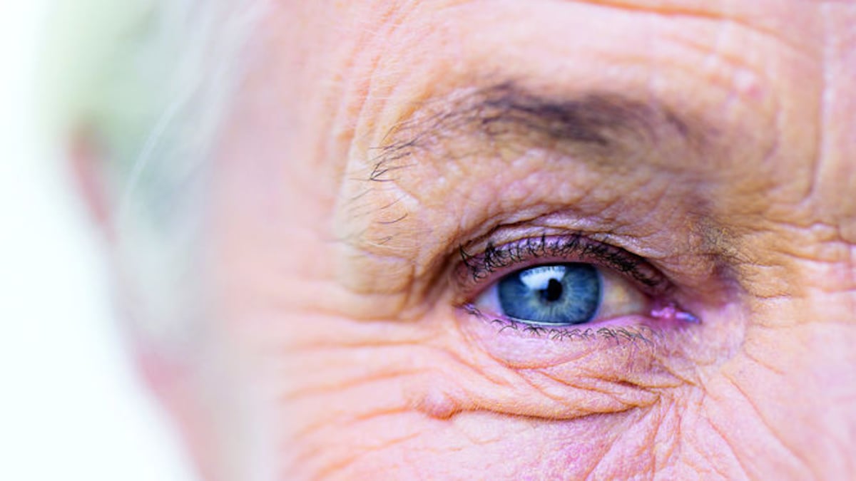 Generalmente, esta dificultad ocurre en personas mayores de 40 años de edad y raramente aparece antes de la pubertad. Fotolia
