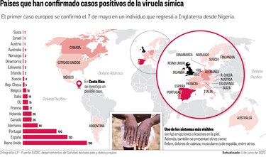 Brote de viruela símica: ¿qué razones hay para ser optimista?