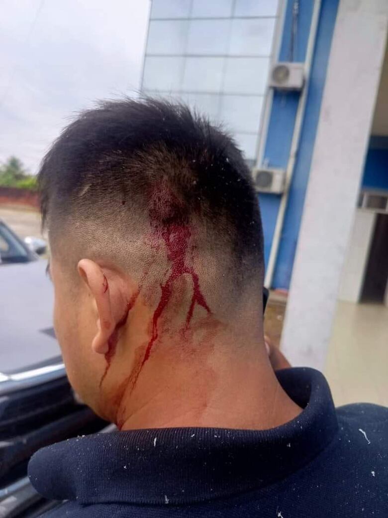 El presidente de Bolivia ordena que se investigue el ataque que sufrió Evo Morales