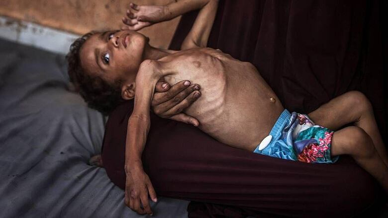 “Desde la Segunda Guerra Mundial no ha habido ningún caso de hambruna tan minuciosamente diseñada y controlada como la de Gaza”: experto en hambrunas Alex de Waal