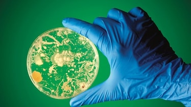 Científicos desarrollan tecnología para detectar bacterias en minutos
