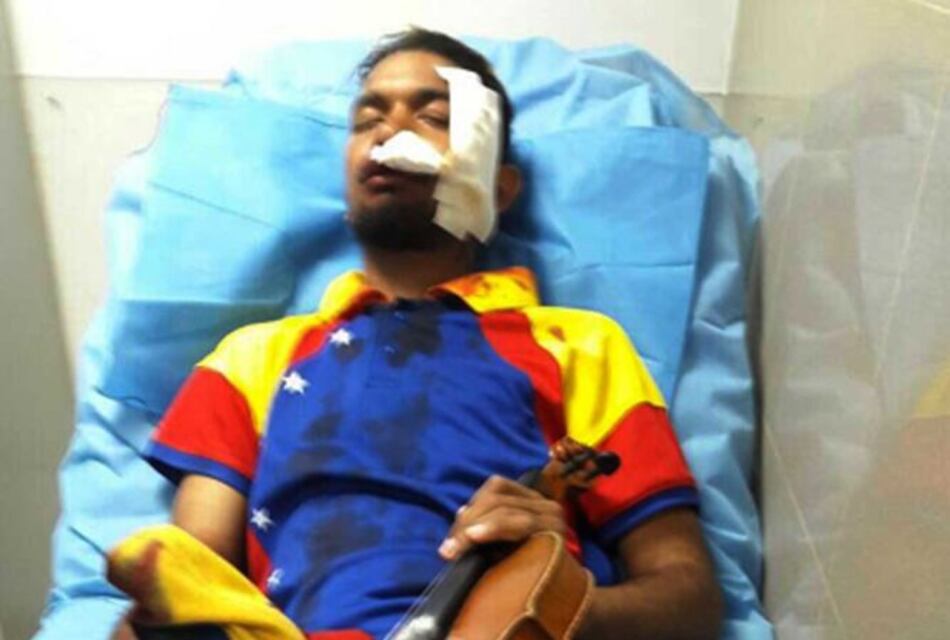 Wuilly Arteaga fue golpeado y le quemaron el cabello en la prisión