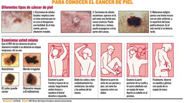 Cuando el Sol intenta seducir