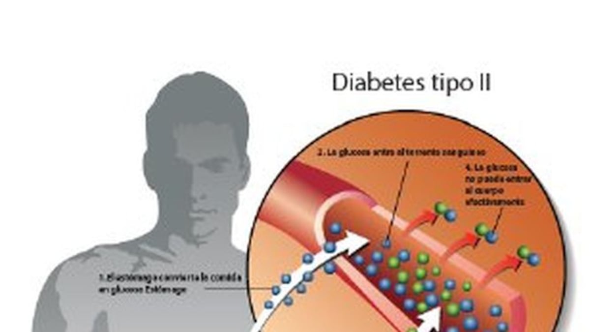 El tipo de diabetes mellitus más común en Panamá y en el mundo es el 2, que representa cerca del 90% de los casos.