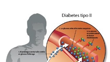 Plantean crear consejo y registro nacional para enfrentar el creciente impacto de la diabetes