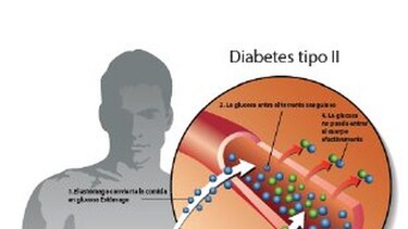 La presencia de la diabetes