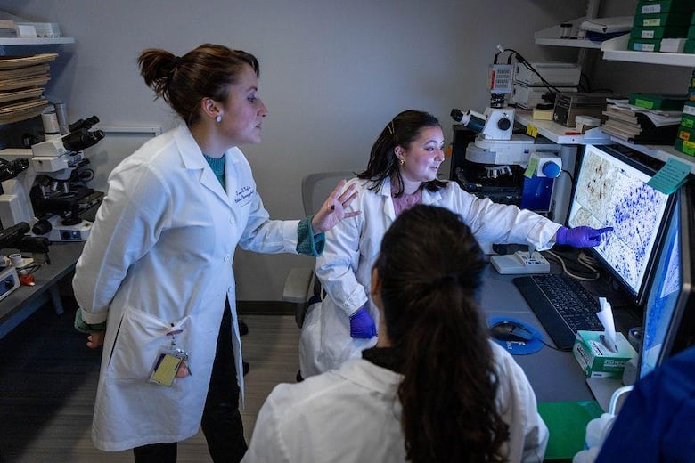 Cómo son los cerebros de los ‘superancianos’