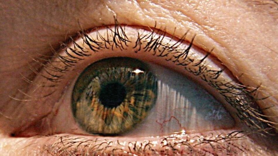 Podrían detectar alzhéimer por medio de la vista