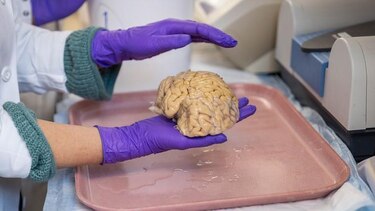 Cómo son los cerebros de los ‘superancianos’
