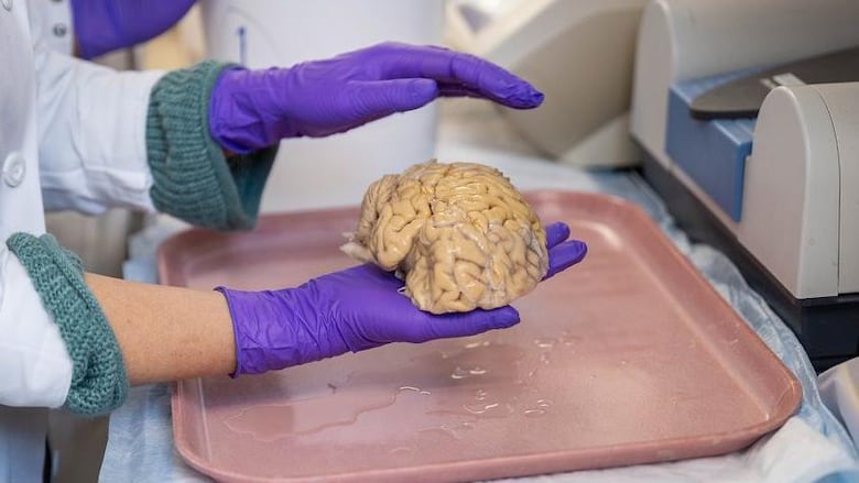 Cómo son los cerebros de los ‘superancianos’