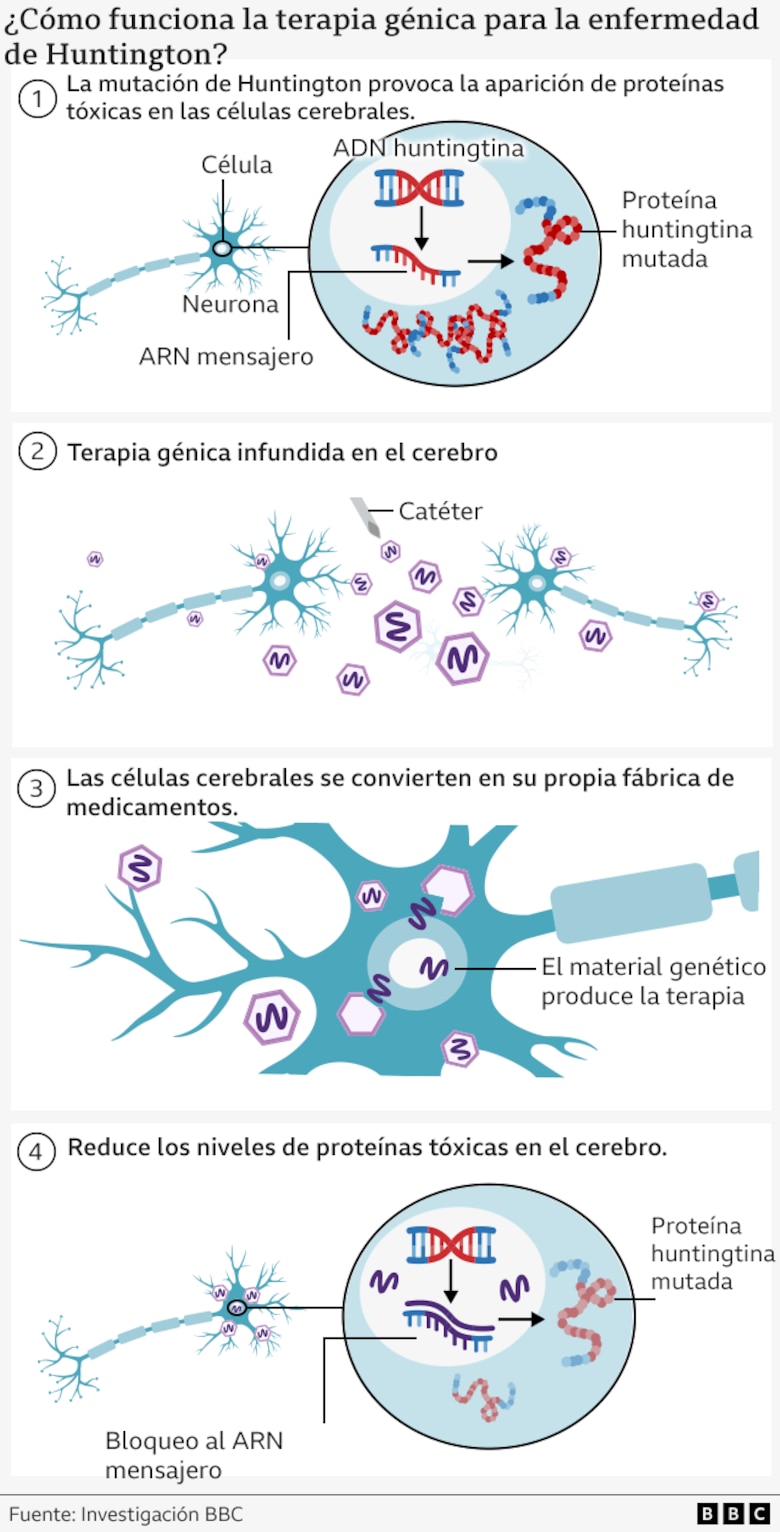 En qué consiste el primer tratamiento efectivo contra la devastadora enfermedad de Huntington