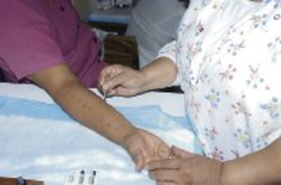 ‘Prick test’ para las alergias
