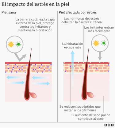 Cómo el estrés afecta a tu piel (y qué puedes hacer al respecto)