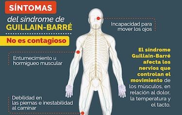 Perú emite una alerta epidemiológica ante más de 100 casos del Síndrome de Guillain Barré