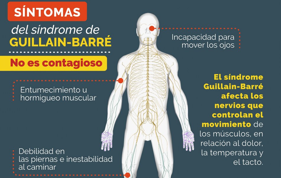 Perú emite una alerta epidemiológica ante más de 100 casos del Síndrome de Guillain Barré