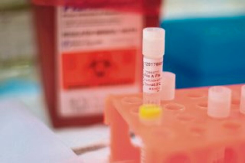 Genoma del ébola podría ayudar a hallar tratamiento